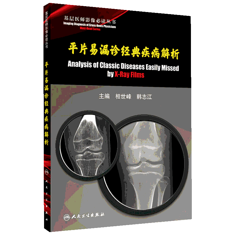 平片易漏诊经典疾病解析 相世峰,韩志江 编 影像医学生活 新华书店正版图书籍 人民卫生出版社