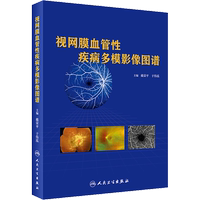 視網(wǎng)膜血管性疾病多模影像圖譜 戴榮平.于偉泓 編 眼科學(xué)生活 新華書店正版圖書籍 人民衛(wèi)生出版社
