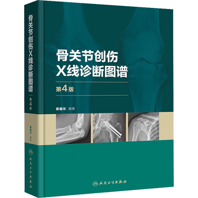 骨关节创伤X线诊断图谱 第4版 黄耀华 编 外科学生活 新华书店正版图书籍 人民卫生出版社