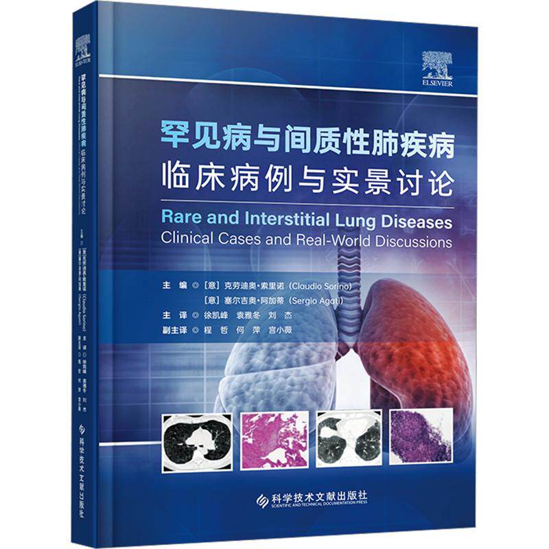 罕见病与间质性肺疾病临床病例与实景讨论