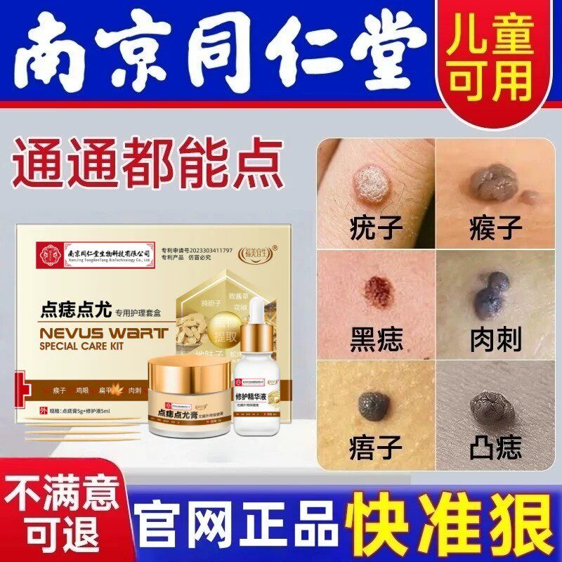 南京同仁堂点痣药水不留疤点痣膏无痕正品官网店美容脸祛痣点痣膏