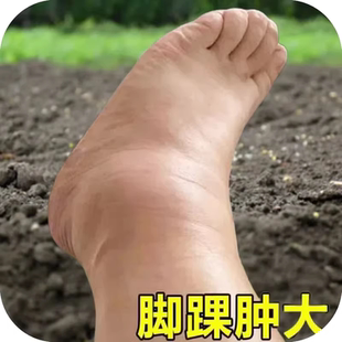 脚踝受伤崴脚走路神器扭伤脚踝热敷脚腕疼痛韧带拉伤恢复专用药膏