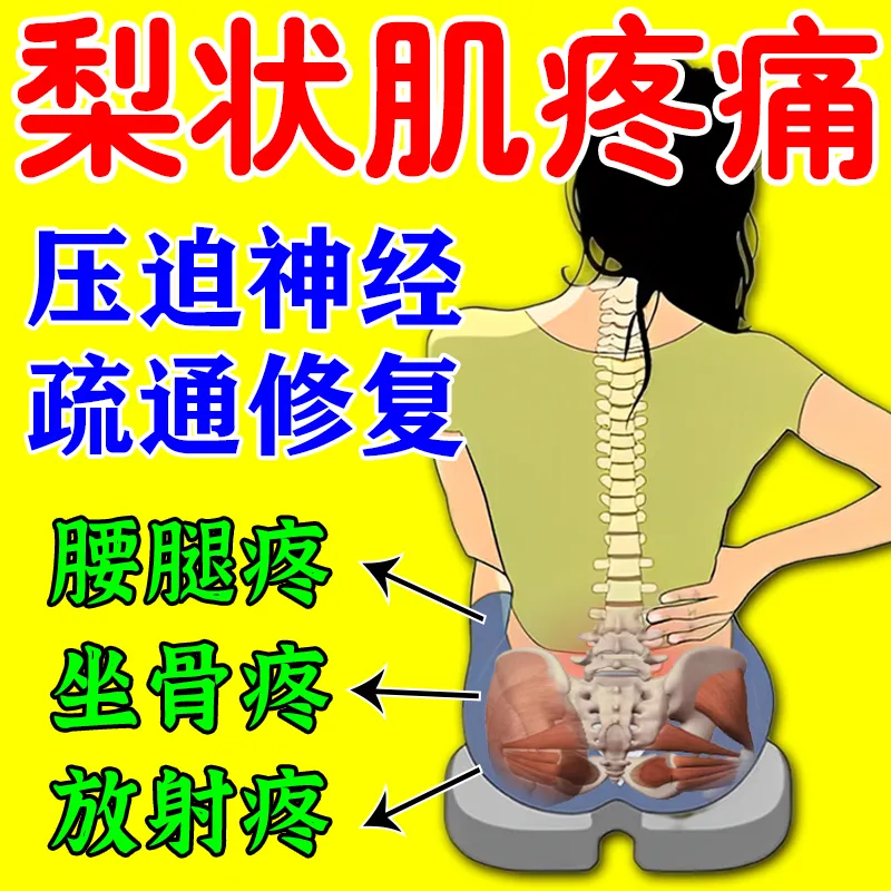 梨状肌综合症特效药治疗腰椎压迫坐骨神经腿疼屁股疼膏药贴神器