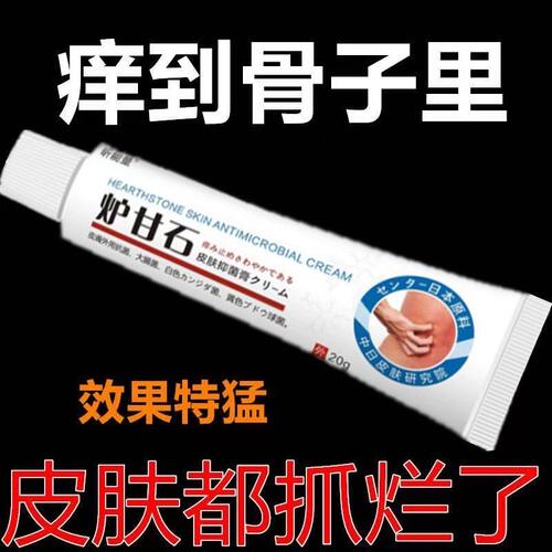 炉甘石软膏疹湿止痒根去外用顽固皮炎皮肤瘙痒抑菌乳膏男女专用