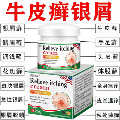 美国进口牛皮癣银屑病湿疹止痒