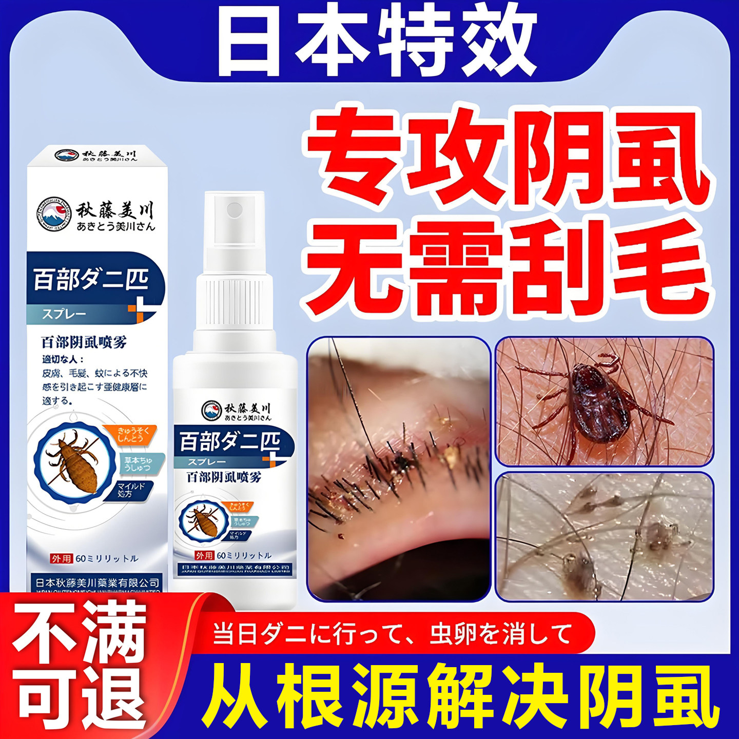 百部酊灭阴虱喷剂用专虫卵男女私处阴虱去除非药虱立净旗舰店