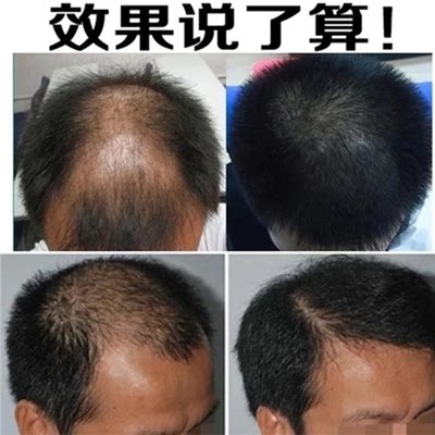 【古方生发液】增长液快速变长生洗发水