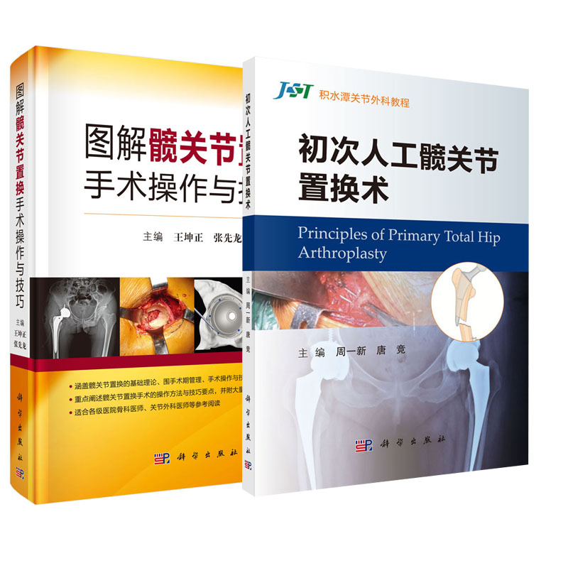 【全2册】初次人工髋关节置换术+图解髋关节置换手术操作与技巧髋关节置换基础理论手术操作与技巧并发症及前沿技术科学出版社