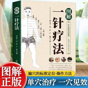 图解一针疗法正版 针虽细物道通神上合于天下合人中医学针灸教程书针灸疗法穴位中医临床腧穴定位操作方法书籍中国科学技术出版社