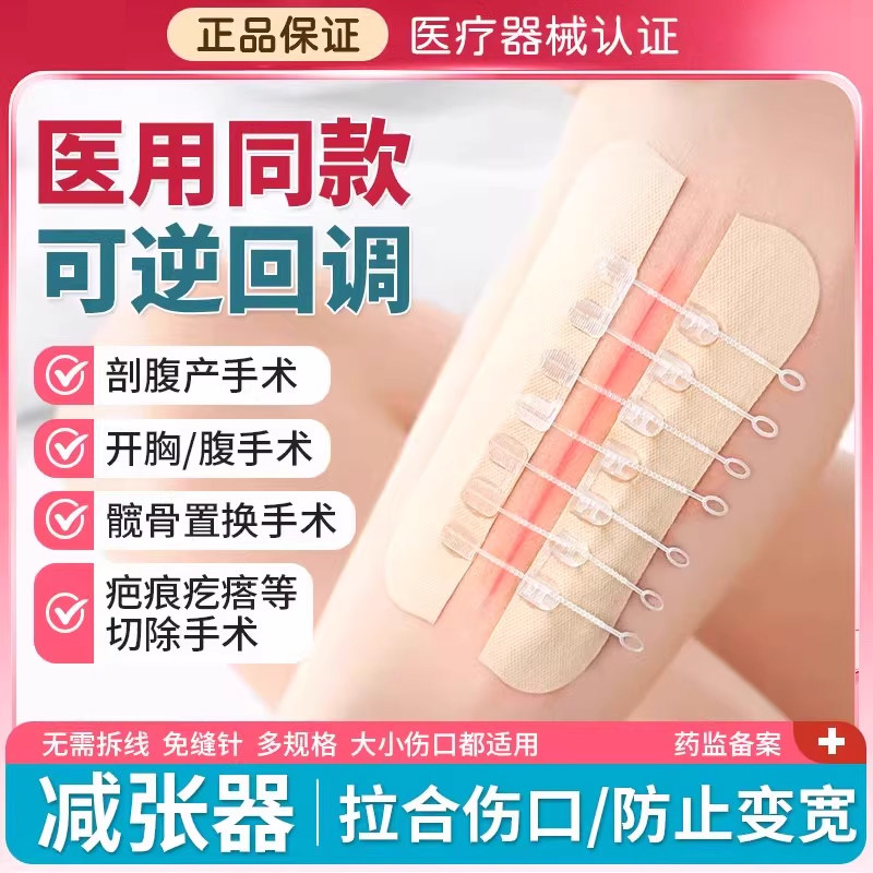 医用减张器剖腹产术后疤痕减张贴
