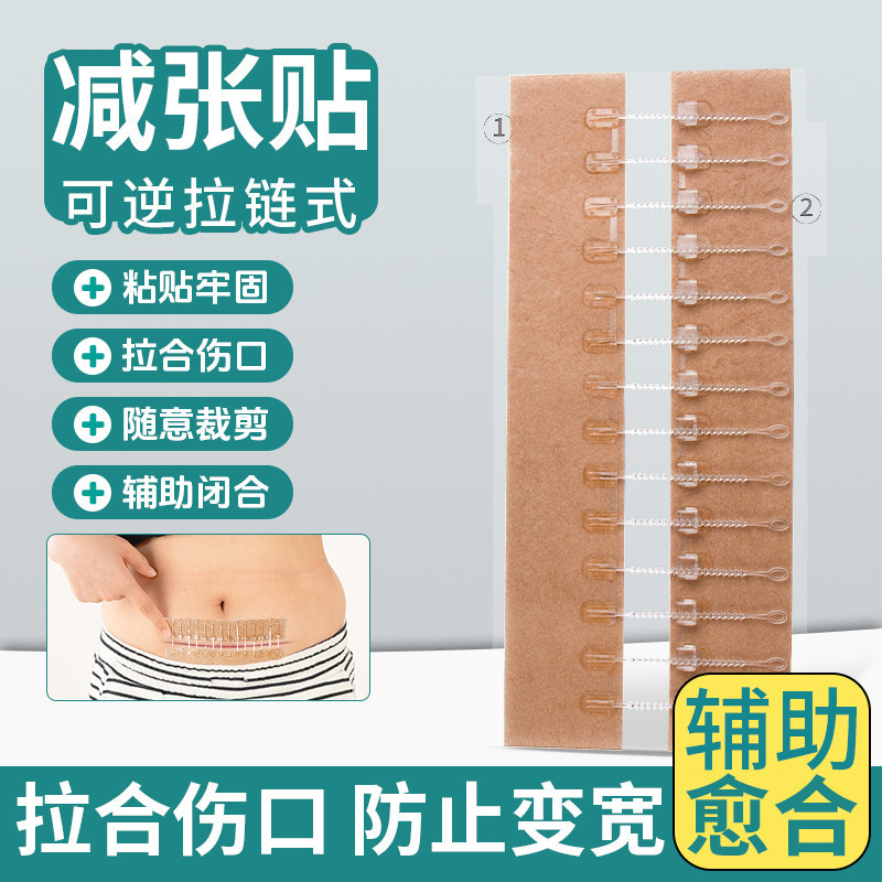 医用减张器剖腹产术后疤痕减张贴