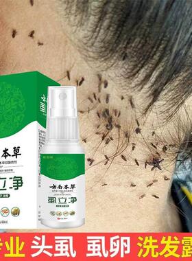 虱子药头发虱立净去除虱卵小女孩头发儿童去头虱子的药虱立净小孩