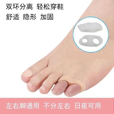 婴儿脚趾矫正器儿童专用宝宝重叠分趾器纠正神器拇指外翻小孩