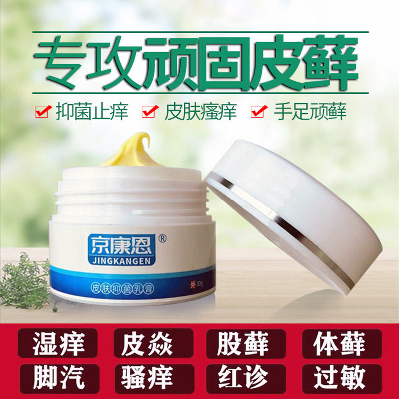 京康恩手脚汗泡起小泡汗泡疹神经性皮肤止痒膏牛皮藓手足藓脱皮痒
