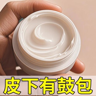 【香港脂肪康】皮下鼓包硬块凸起手脚全身可用草本肿块硬块涂抹膏