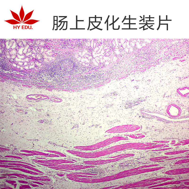 【红叶】 高教病理类组织标本生物标本成像清晰肠上皮化生切片
