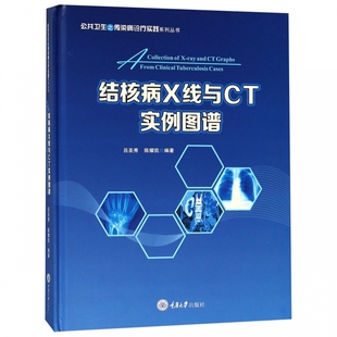 结核病X线与CT实例图谱 公共卫生之传染病诊疗实践 精