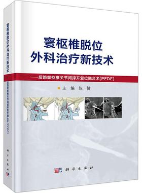 寰枢椎脱位外科治疗新技术——后路寰枢椎关节间撑开复位融合术（PFDF）