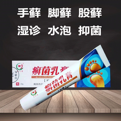 足之爱癣菌乳膏手藓湿诊水泡脚汗