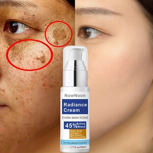 EVEN SKIN Blend Radiance Kojic Active Cream 45% NowNoon TONE