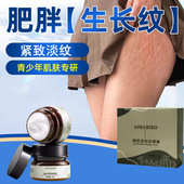 青少年肥胖纹修复膏淡化紧致生长纹修护霜去大腿学生淡纹妊娠精油