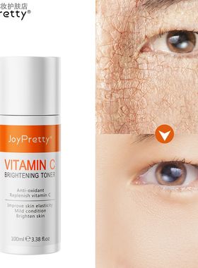 JOYPRETTY爽肤水 补水保湿滋润清爽提亮肤色维C嫩柔肤 VC精华水