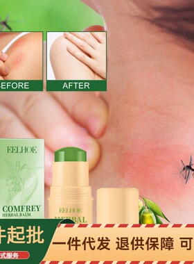 EELHOE 皮肤止痒紫草膏 缓解蚊虫叮咬瘙痒不适修护光滑细腻皮肤