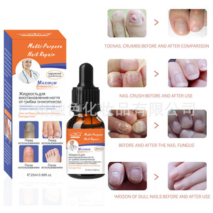 跨境英俄文装指甲护理精华清洁黑甲手指甲Repair Nail  Fungus