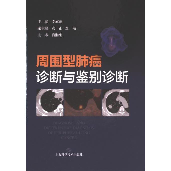 周围型肺癌诊断与鉴别诊断 主编李成州 9787547863985