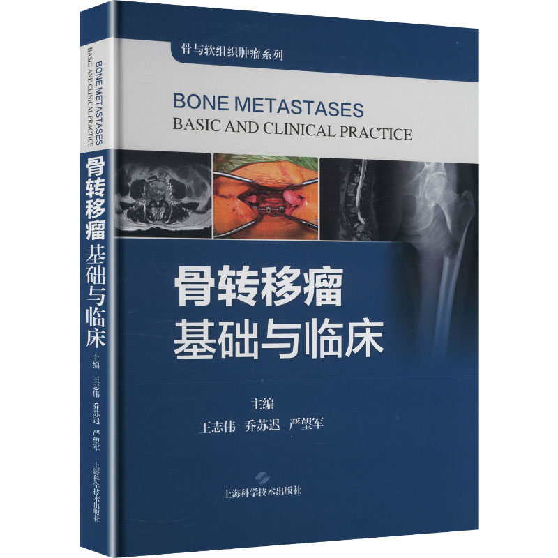 骨转移瘤基础与临床 主编王志伟, 乔苏迟, 严望军 9787547874295