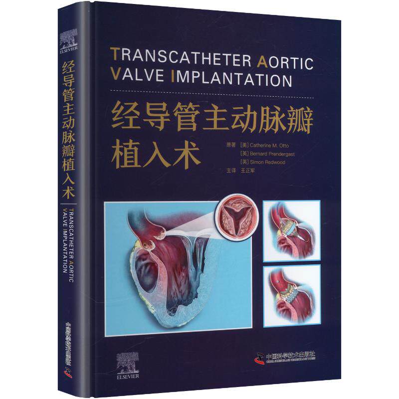 经导管主动脉瓣植入术原著 (美) Catherine M. Otto, (英) Bernard Prendergast, Simon Redwood中国科学技术出版社9787523617489