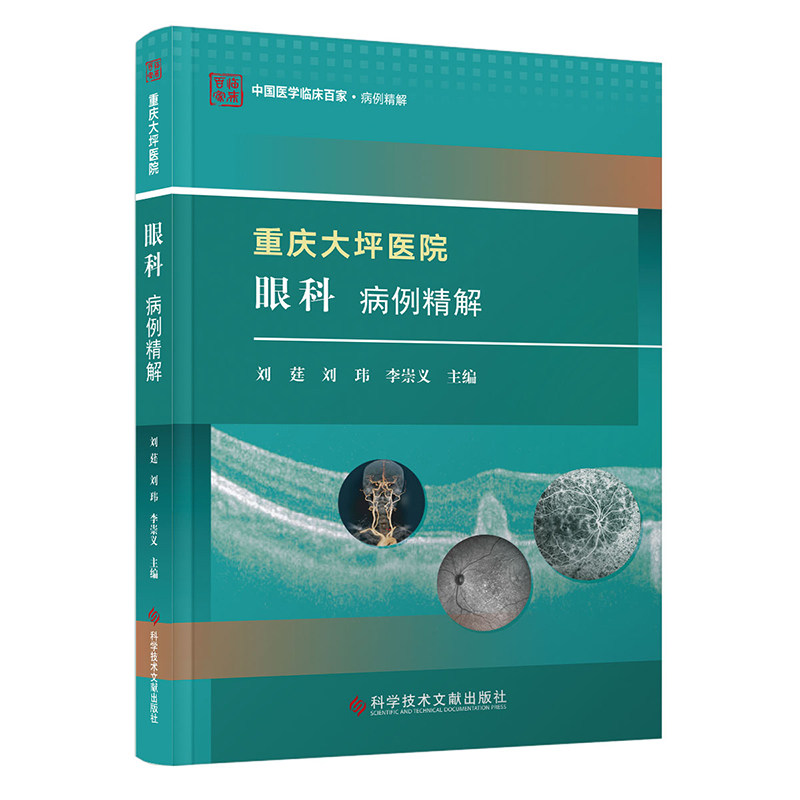 重庆大坪医院眼科病例精解 刘莛, 刘玮, 李崇义主编 9787523512074
