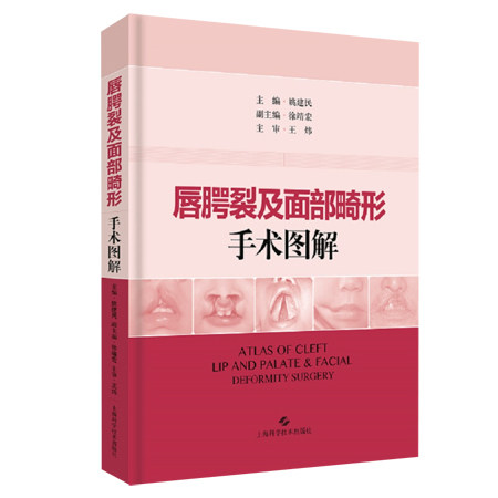 唇腭裂及面部畸形手术图解 整形外科 口腔外科 美容外科及耳鼻喉科临床医师常用的唇腭裂手术 上海科学技术出版社9787547842898
