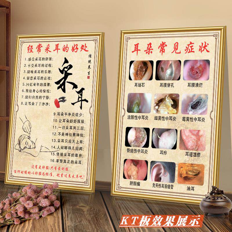 中耳炎海报耳病挂图耳穴疗法宣传画采耳店墙贴挂画耳烛装饰画定制