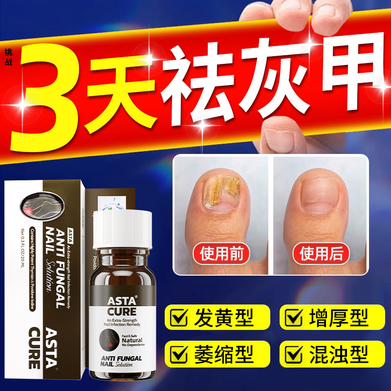 灰指甲特效药根治第一名专用药正品官方旗舰店亮甲治疗进口药