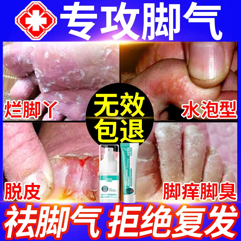 【热销荷兰进口】医用去脚气第1名