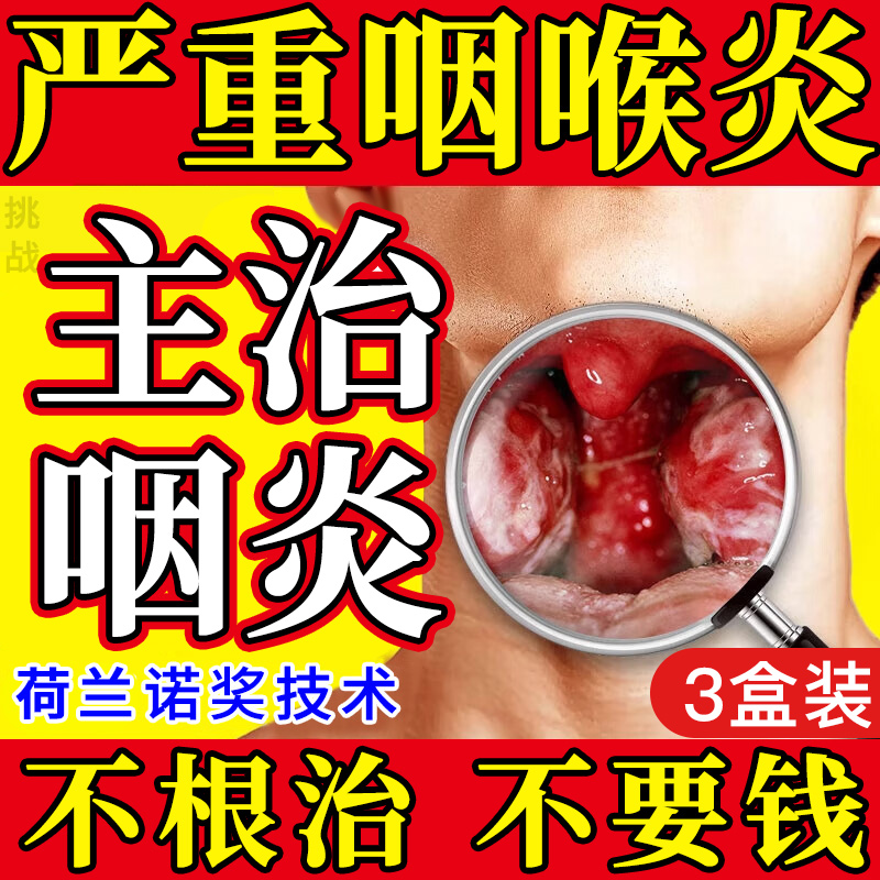 【自营】进口急慢性咽炎专用特效药咽喉炎异物感咳嗽喉咙干痒痛肿