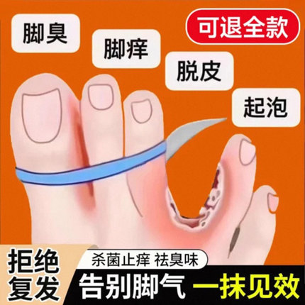 【自营】脚气喷雾止痒脱皮杀菌真菌感染去根专用特效药糜烂脚丫趾