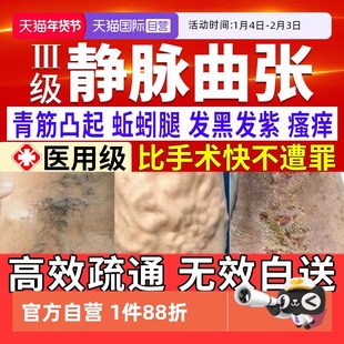 【自营】静脉曲张特效药官方旗舰店专用药膏冷敷凝胶青筋凸起贴膏