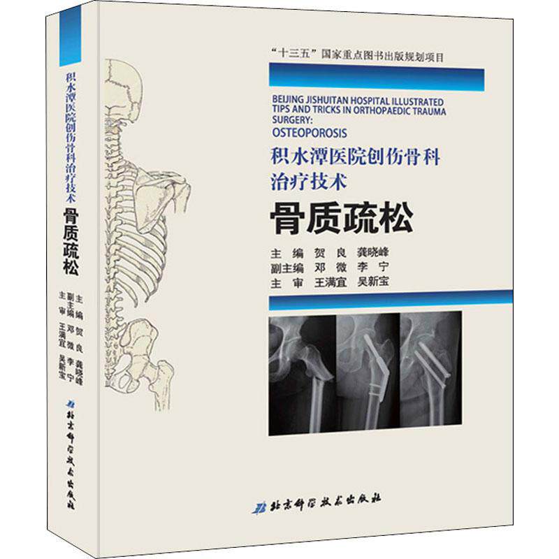 正版包邮 积水潭医院创伤骨科治疗技术:骨质疏松 贺良龚晓峰 风湿关节颈椎病书籍 十三五国家重点图书出版规划项目
