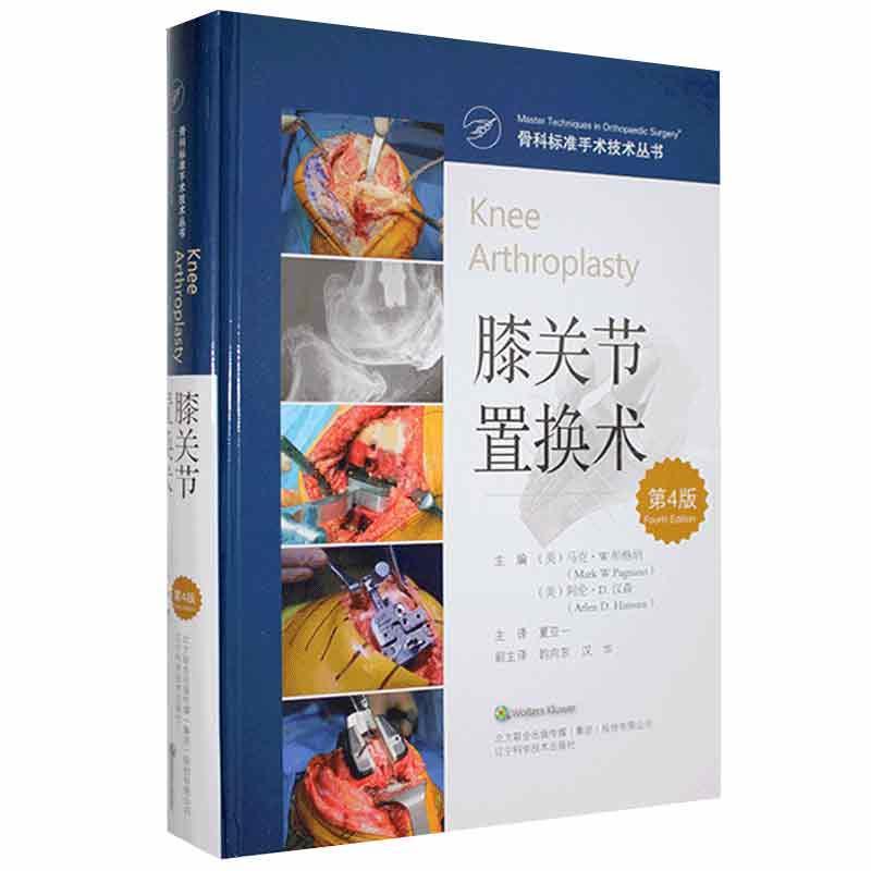 膝关节置换术马克·帕格医药卫生书籍