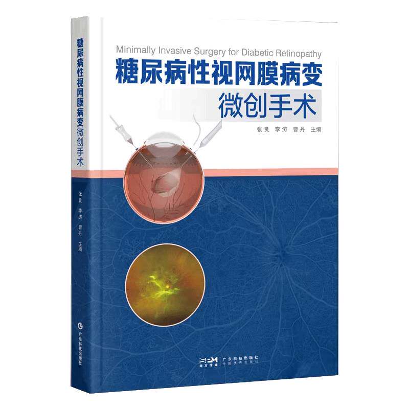 糖尿病性视网膜病变微创手术 配有27个手术视频 关注手术操作细节 包括器械准备参数设置出血控制增殖膜处理等关键环节 出版社正品