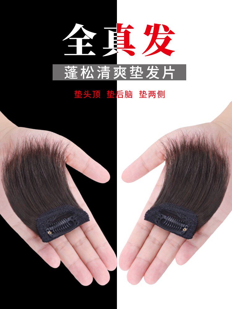 额角补发贴男发际线补发男女士鬓角贴头皮假发片两侧边前额头无u