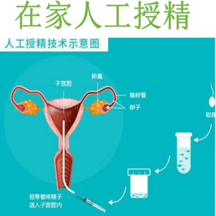 人工受精助孕器家用备孕授精辅助用品医用硅胶输精管辅助生殖工具