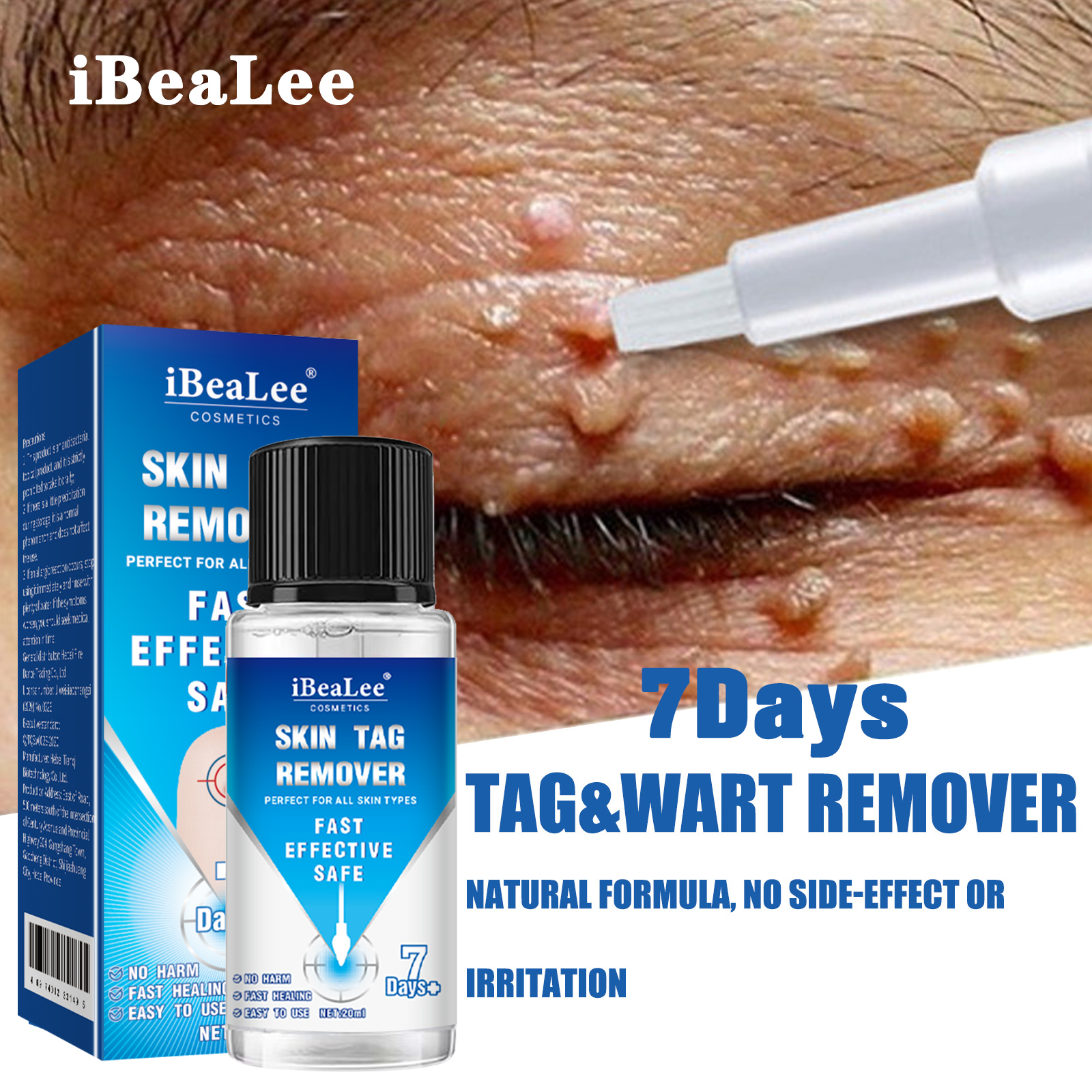 7Days Skin Tag Removal Serum Warts Remover Pen Painless Papi-封面