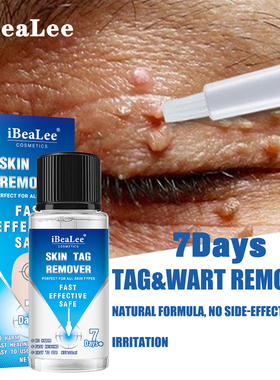 7Days Skin Tag Removal Serum Warts Remover Pen Painless Papi