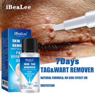 Remover Tag 7Days Warts Removal Serum Pen Skin Painless Papi