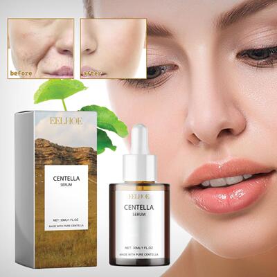 Centella asiatica essence improves face smoothes brightens