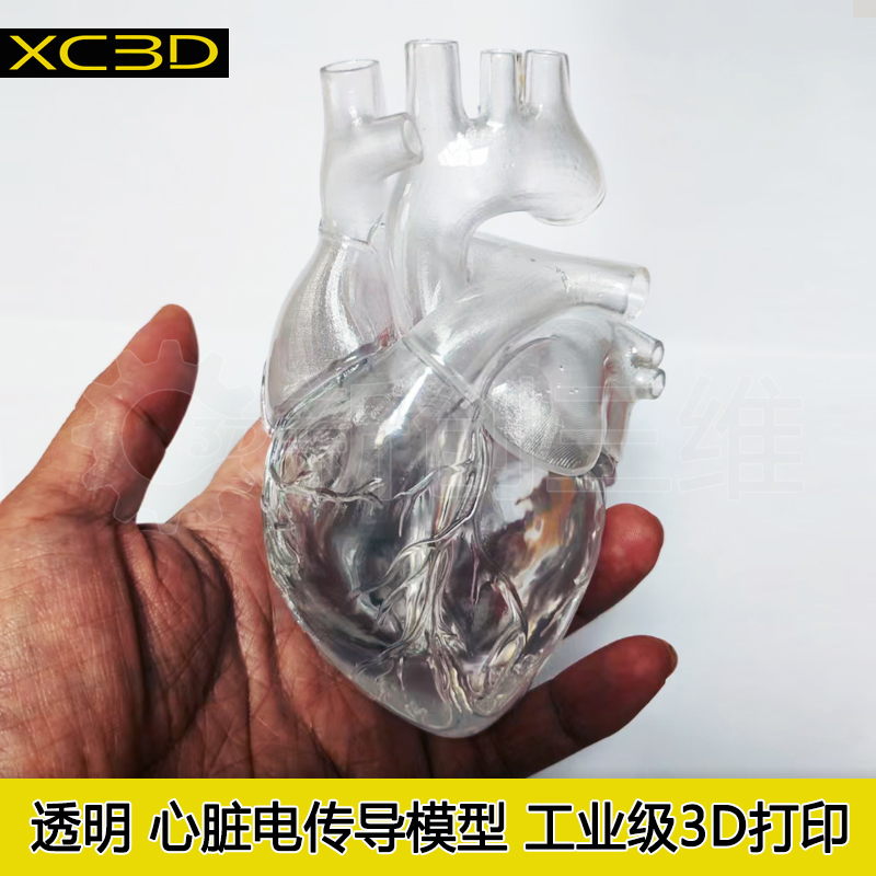 电传导心脏心脏病房室间隔缺损