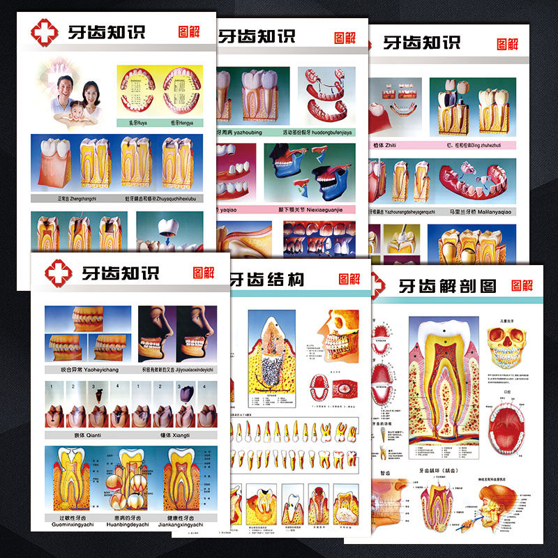剖图海报示意知识牙齿正畸图解牙科结构图疾病宣传画挂图wsa口腔